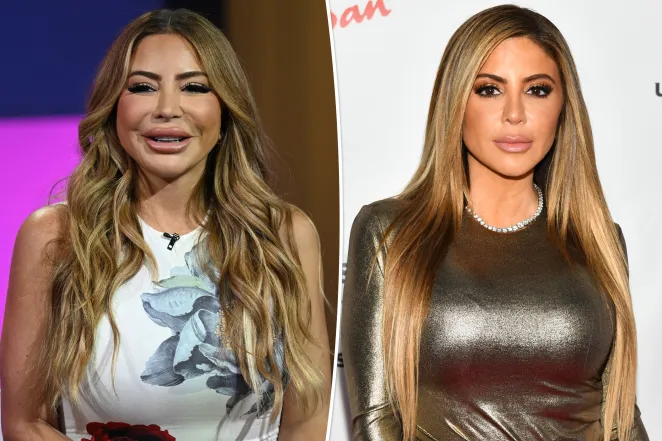 Larsa Pippen blames 'allergic reaction' for her shocking face transformation