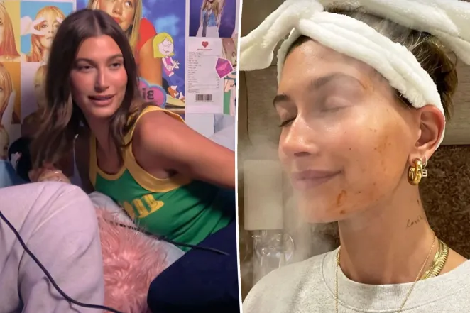 Hailey Bieber confirms she has 'no Botox' in her face — and reveals the treatments she gets instead